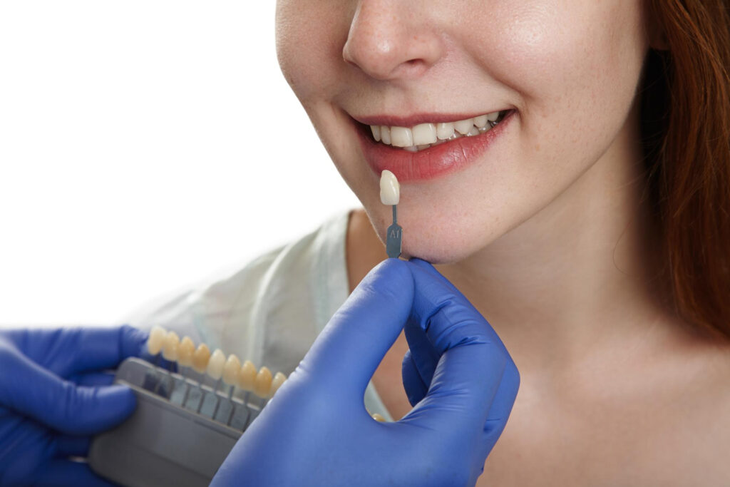 The Basics of Crowns & What You Need to Know