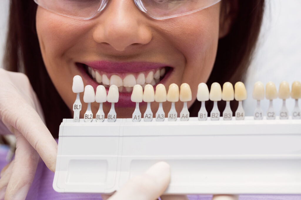 The Lifespan of Temporary Crowns